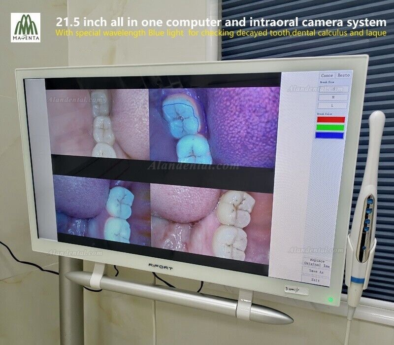 Magenta YF-2200P+ Dental 21.5 Inch Touch Screen Intraoral Camera VGA+HDMI